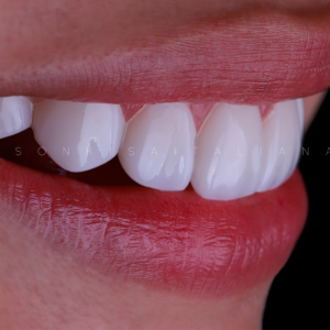 PERSONALIZADO DE RESINA Y CERÁMICA